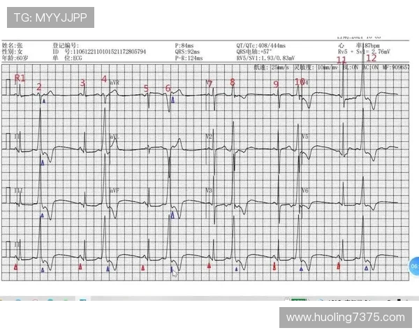 北京乒乓球队区域防守策略解析及其对比赛胜负的影响